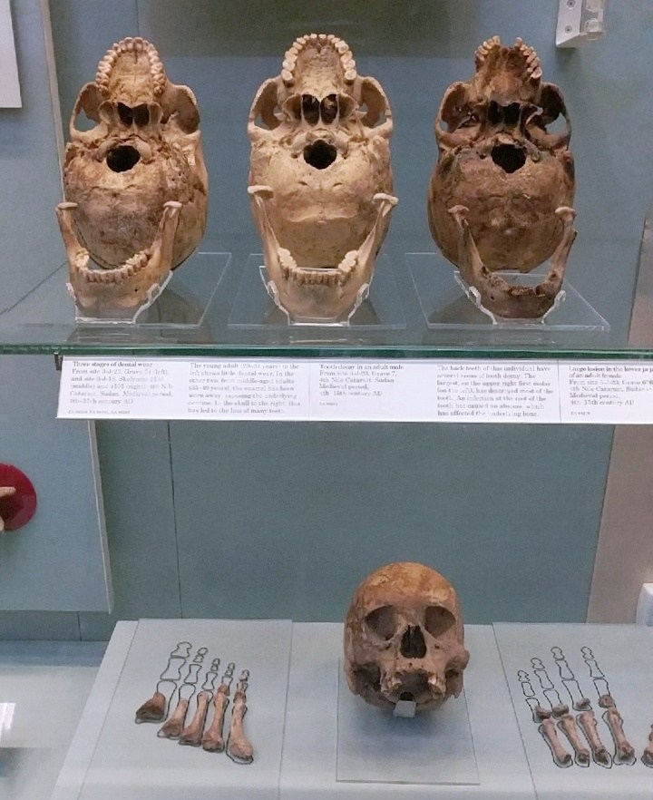 The Human Body and the Nile Valley: 10 Incredible Objects in the British Museum